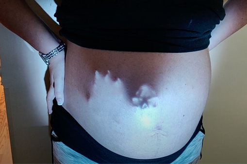 Oh Baby! AtmosFAN Documents Unusual Pregnancy